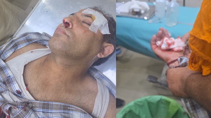 अंबाला में दो युवकों पर धारदार हथियार से हमला, अस्पताल तक पीछा कर किया हमला