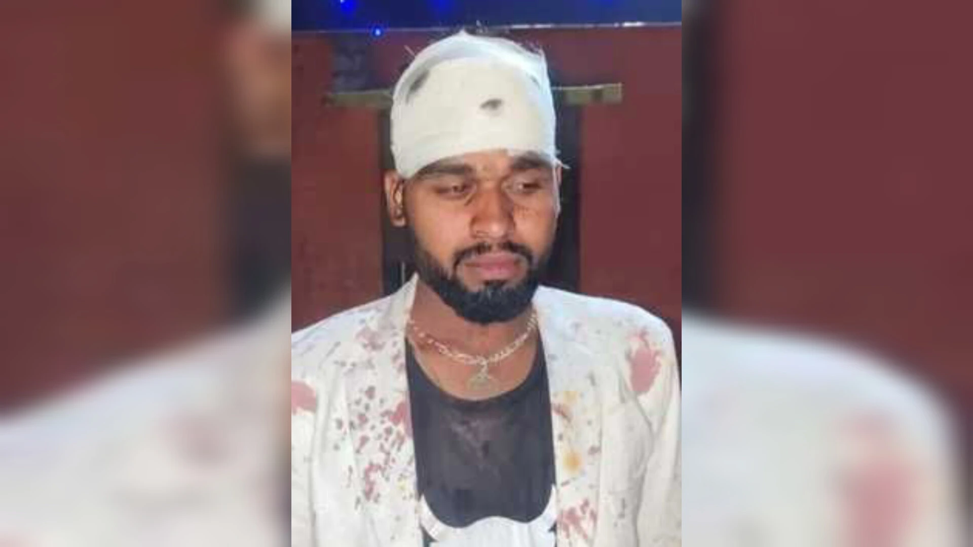 मवाना में शादी समारोह में दो भाइयों पर लाठी-डंडों से हमला, दोनों घायल