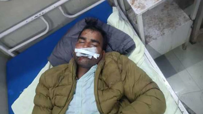 निकरौसी में शामिल होने जा रहे दूल्हे का चाइनीज मांझा से होठ कटा, बाल-बाल बचा छोटा भाई