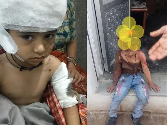 बीकानेर: स्कूल में आवारा कुत्तों का हमला, 4 वर्षीय बच्चे की हालत गंभीर
