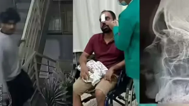 बेंगलुरु में डिलीवरी ब्वॉय ने घूसा मारकर तोड़ी ग्राहक की नाक, गिरफ्तार