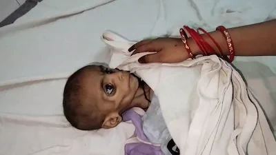 झालावाड़: बस की सीट पर दो साल के कुपोषित मासूम को छोड़कर फरार हुए परिजन