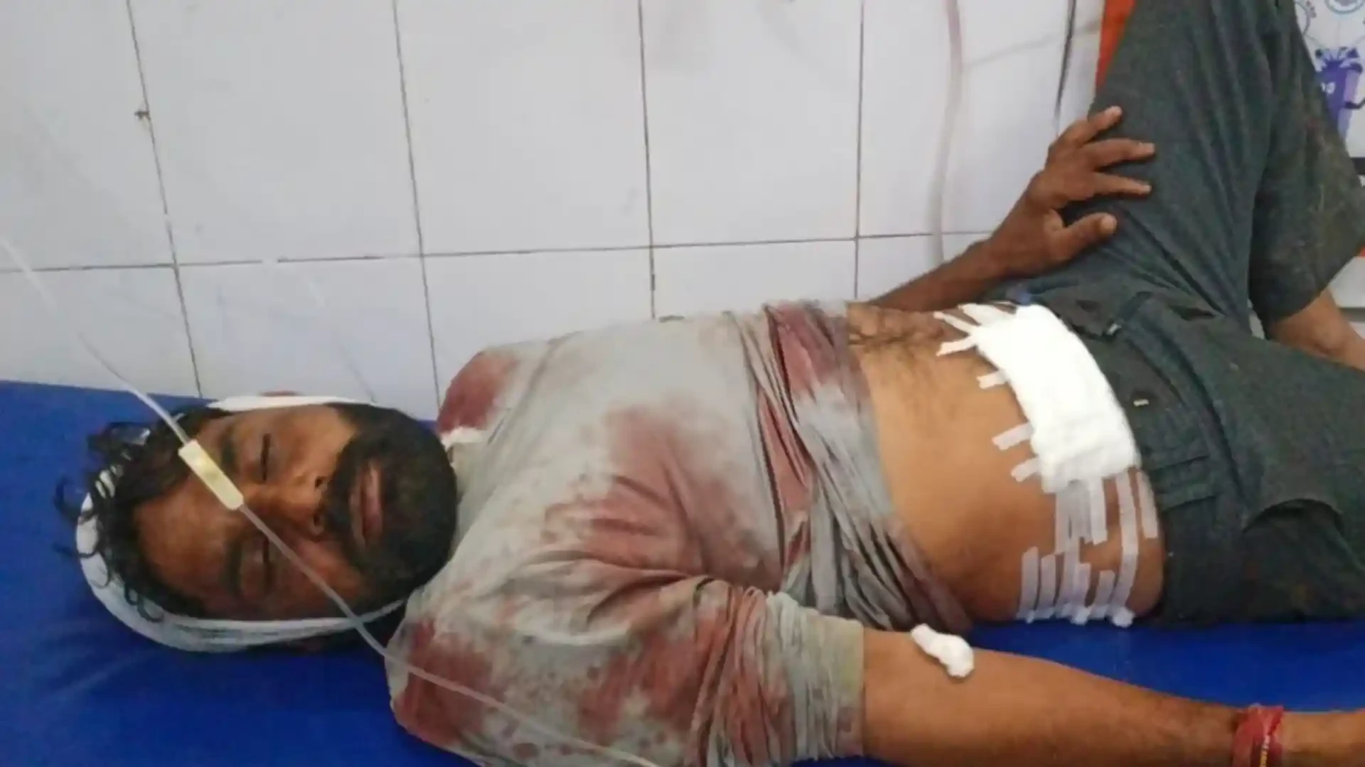 मुजफ्फरनगर: कुतुबपुर दताना गांव में मामूली विवाद में चली गोलियां, दो युवक घायल