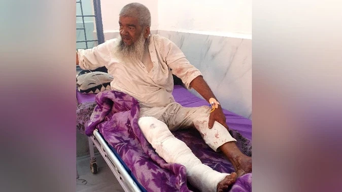 मदरसा विवाद से जुड़ा मामला? नूनाबड़ी में फायरिंग से फैली दहशत, दो लोग घायल
