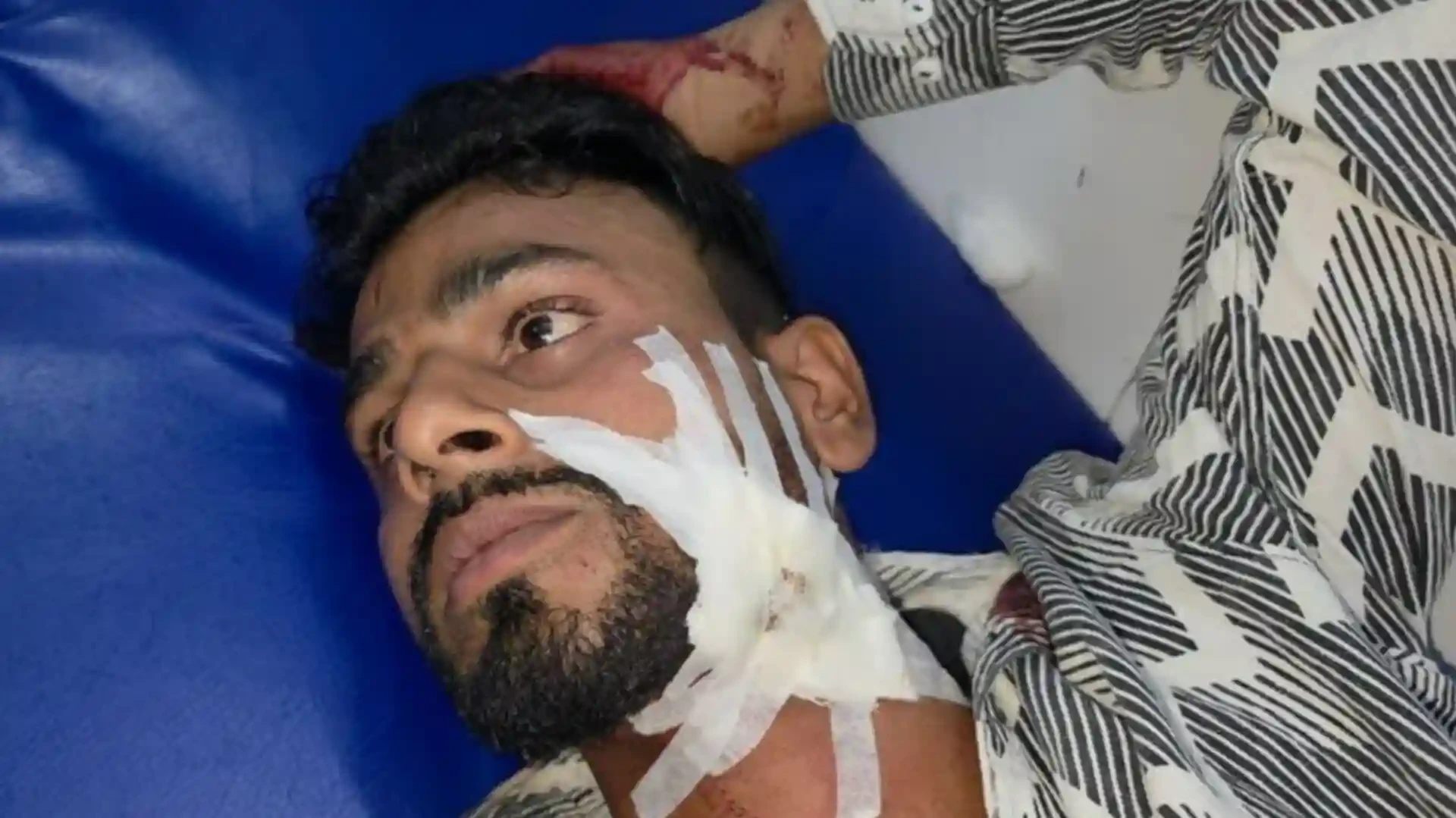 मुजफ्फरनगर: चलती कार पर बाइक सवारों ने बरसाईं गोलियां, युवक गंभीर घायल
