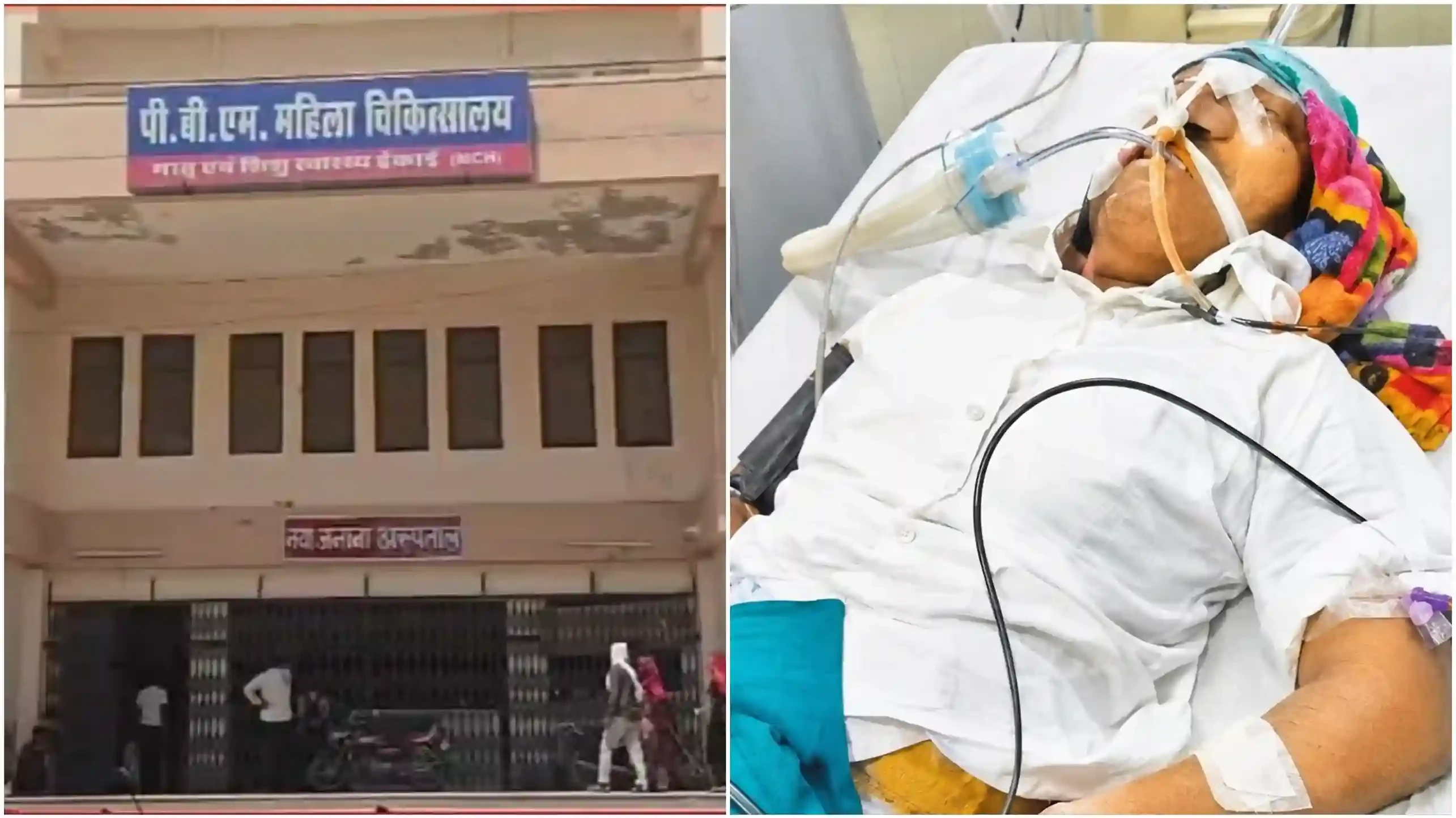 सिजेरियन डिलीवरी के बाद 6 प्रसूताओं की किडनी फेल, बीकानेर PBM अस्पताल में मचा हड़कंप