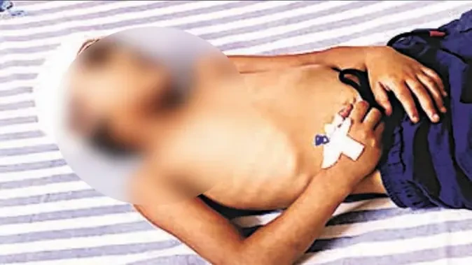 मेरठ: नशे में धुत युवक ने 4 साल के मासूम पर किया जानलेवा हमला