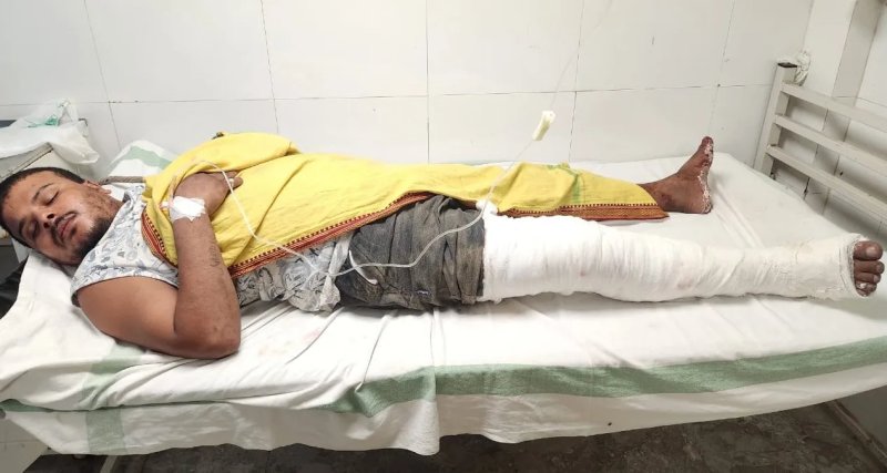 पटना बंटी हत्याकांड: मुठभेड़ में मुख्य आरोपी रविश गिरफ्तार, पैर में लगी गोली