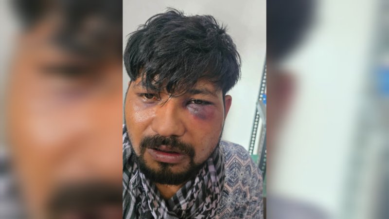 देहरादून में युवक के साथ हैवानियत, अगवा कर करंट लगाया और गुप्तांग में घुसाया पेचकस