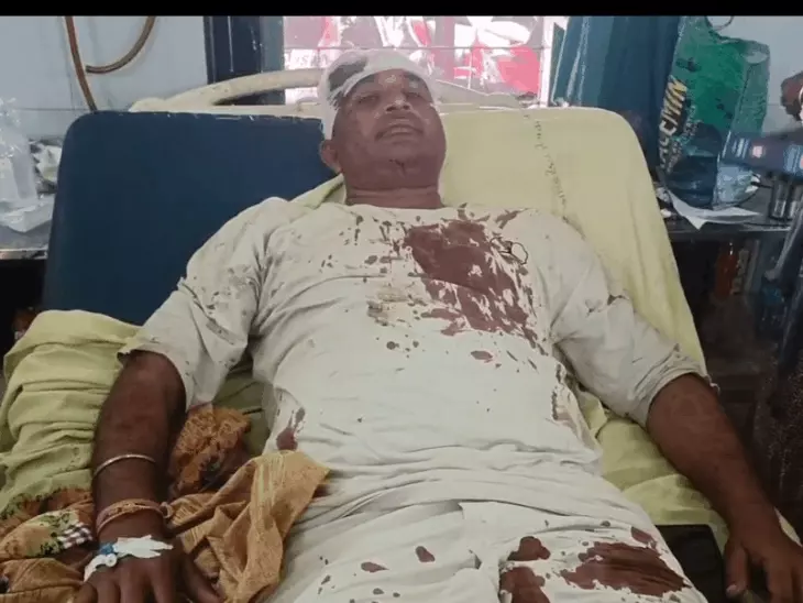 मुजफ्फरनगर: बाइक निकालने को लेकर विवाद में युवक और पत्नी पर हमला