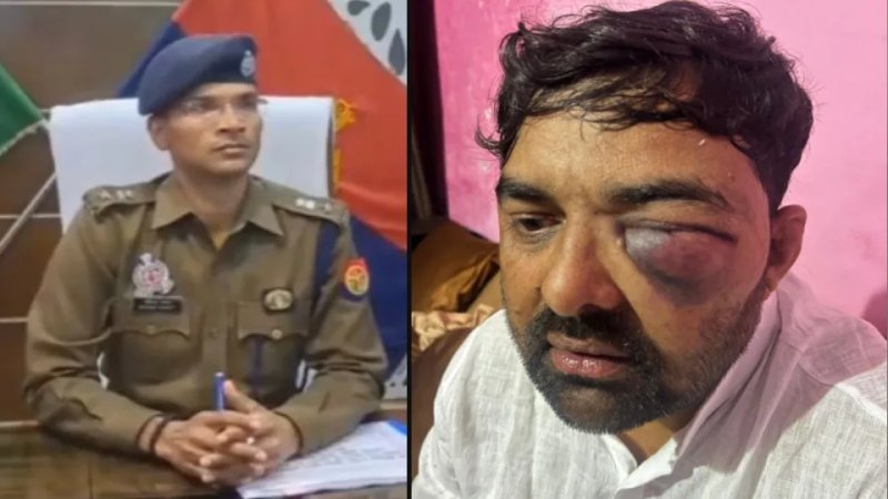 मेरठ: सपा नेता ने SSP पर लगाए गंभीर आरोप, बोले- चैंबर में लात-घूंसों और जूतों से पीटा