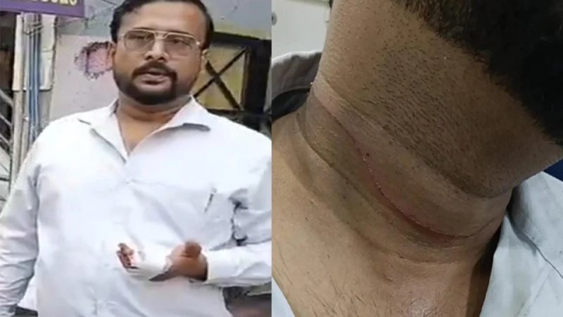 चाइनीज मांझे से बैंक अधिकारी घायल, गर्दन बचाने में उंगली पर आई गहरी चोट