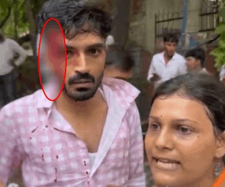 डीयू नॉर्थ कैंपस में चुनाव प्रचार के दौरान भिड़े छात्र, दो मामूली रूप से घायल