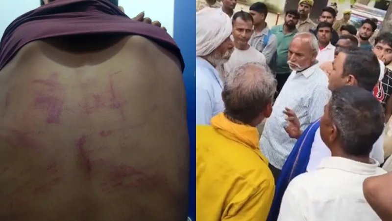 बिजनौर: भाजपा विधायक सुशांत सिंह पर तीन युवकों की पिटाई का आरोप, एक अस्पताल में भर्ती