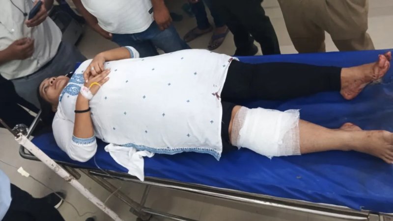 वाराणसी SBI में रिवॉल्वर गिरने से चली गोली, महिला बैंककर्मी घायल
