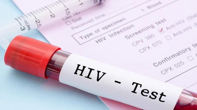 छतरपुर में गिरफ्तारी के दौरान आरोपी ने कांस्टेबल को काटा, निकला HIV पॉजिटिव